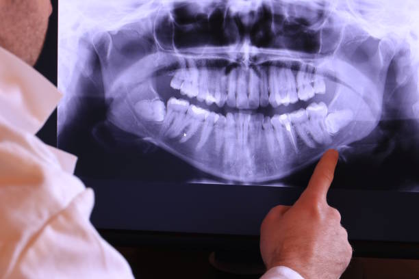 Best Emergency Treatment for Dental Infections or Abscesses in Kearney Park, MS