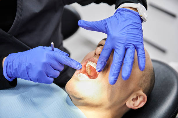 Best Emergency Dental Care for Broken or Chipped Teeth in Kearney Park, MS