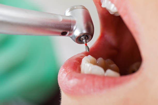 Best Weekend Emergency Dentist in Kearney Park, MS